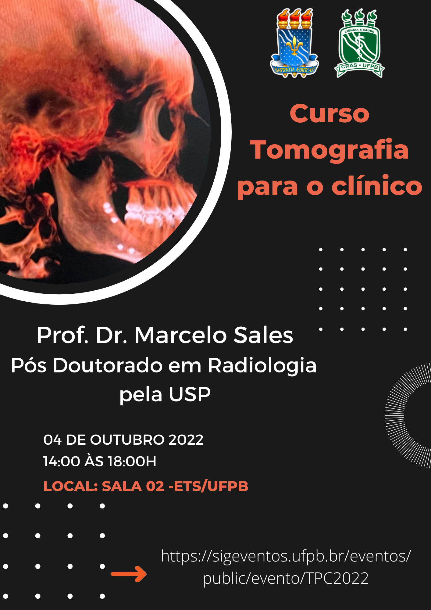 Curso De Tomografia Universidade Federal Da Para Ba Ufpb Centro De Refer Ncia Em Aten O