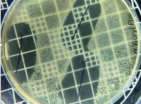 Pesquisadores da UFPB desenvolvem fio de sutura antimicrobiano